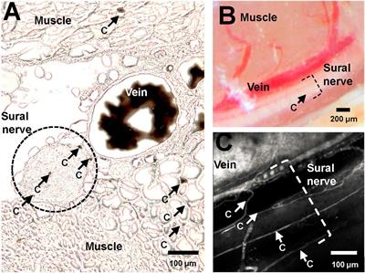 Sural Nerve Perfusion in Mice